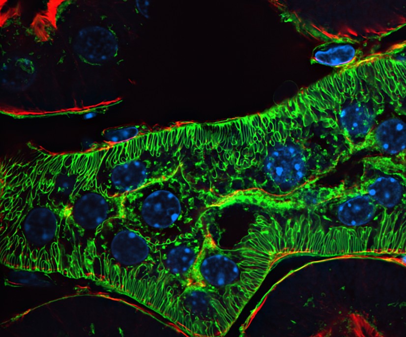 CSR Biotech | Super Resolution Imaging