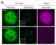 CSR Biotech | Super Resolution Imaging